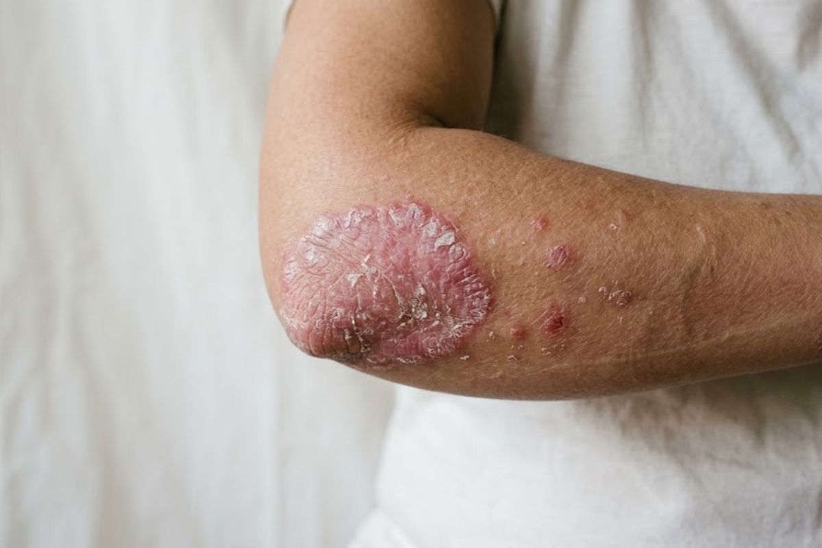 Before treatment